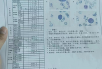 患者检查报告